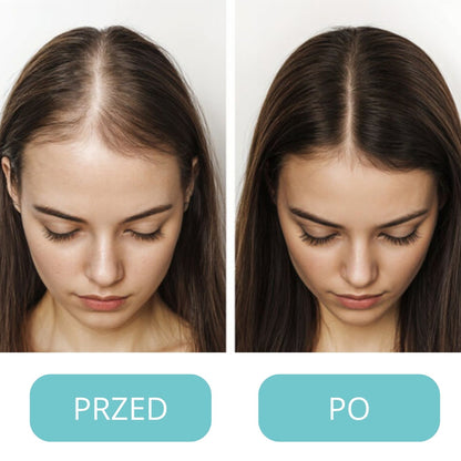 Bodywise Serum na porost włosów