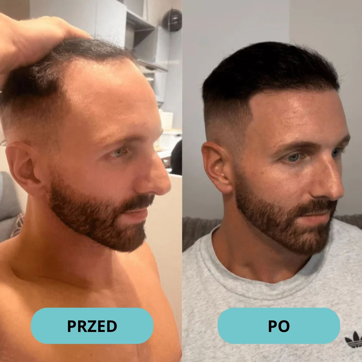 Bodywise Serum na porost włosów